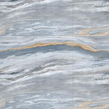 Hard Decoration Of The Whole House-Stone 28